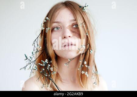 Modello femminile giovane positivo con macchia marrone sulla pelle del viso e fiori delicati sui capelli che si affacciano su sfondo bianco Foto Stock