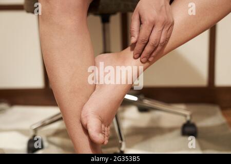 Donna con gonfiore alle gambe, stanca e dolore alle gambe, gonfiore durante la gravidanza. Foto di alta qualità Foto Stock