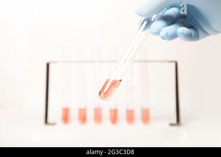 Provette in un rack. Rappresentazione grafica di un grafico a barre, statistiche, dati scientifici, medici, biologici, laboratorio biomedico. Foto Stock