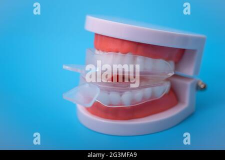 vassoio singolo per sbiancare e modellare. imitazione di una dentiera. Il concetto di mostrare il trattamento dentale. Foto Stock