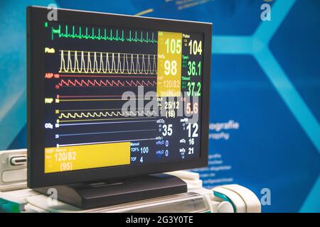 Monitoraggio delle condizioni patientâ€™s e dei segni vitali con un monitor in ospedale, terapia intensiva Foto Stock