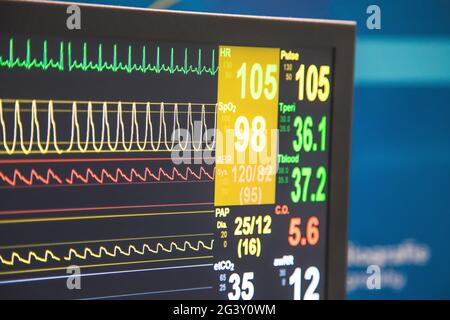 Monitoraggio delle condizioni patientâ€™s e dei segni vitali con un monitor in ospedale, terapia intensiva Foto Stock
