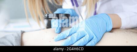 Il medico della donna esamina il segno di nascita di un paziente attraverso la lente di ingrandimento Foto Stock
