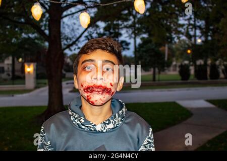 10-31-2017 Tulsa USA - ragazzo vestito per Halloween con orribile zombie bocca cucito insieme con sangue Foto Stock