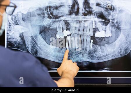 Dentista maschile che esamina i raggi X in clinica Foto Stock