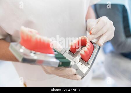 Modello dentista femminile che tiene i denti presso la clinica medica Foto Stock