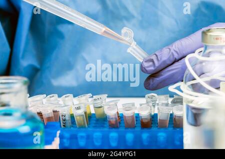 Analisi scientifica del campione di acque reflue in laboratorio, indagine di possibile contaminazione da parte di Sars-Cov-2 nell'uomo, immagine concettuale Foto Stock