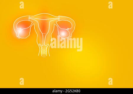 Illustrazione Handrawn dell'utero umano su sfondo giallo. Set medico-scientifico con i principali organi umani con spazio di copia vuoto per testo o infografica. Foto Stock