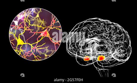 Amigdala e neuroni nel cervello, illustrazione Foto Stock