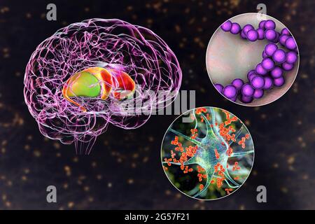 Coro di Sydenham, illustrazione Foto Stock