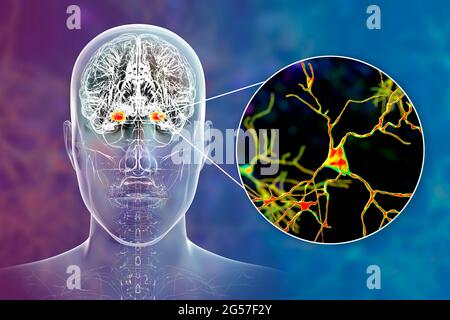 Amigdala e neuroni nel cervello, illustrazione Foto Stock