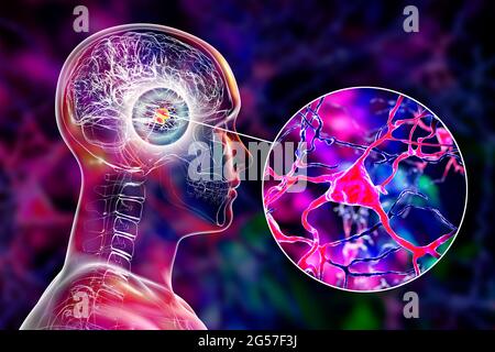 Amigdala e neuroni nel cervello, illustrazione Foto Stock