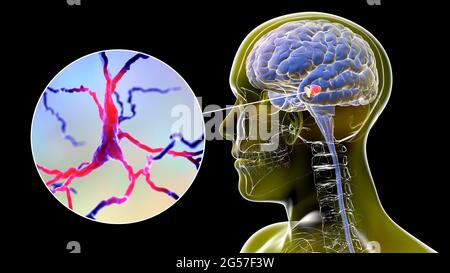 Substria nigra e neuroni dopaminergici, illustrazione Foto Stock