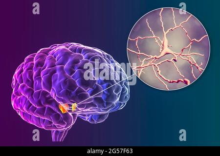 Substria nigra e neuroni dopaminergici, illustrazione Foto Stock