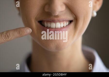 Primo piano giovane donna felice che punta al sorriso togoteo. Foto Stock