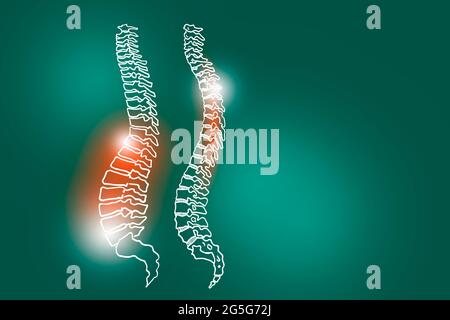 Illustrazione Handrawn della colonna umana su sfondo verde profondo. Set medico-scientifico con i principali organi umani con spazio di copia vuoto per il testo Foto Stock