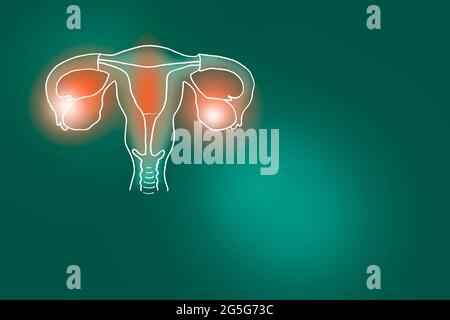 Illustrazione Handrawn dell'utero umano su fondo verde profondo. Set medico-scientifico con i principali organi umani con spazio di copia vuoto per il testo Foto Stock