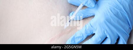 Infermiere iniezione medicinale nei pazienti closeup della cicatrice postoperatoria Foto Stock