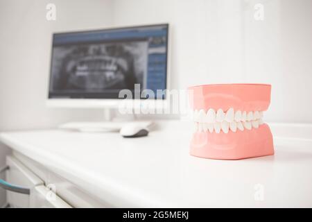 Modello di mascella in plastica presso la clinica dentale, denti x-ray su sfondo Foto Stock