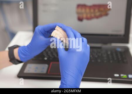 Primo piano di un dentista non riconoscibile che tiene modello dentale Foto Stock