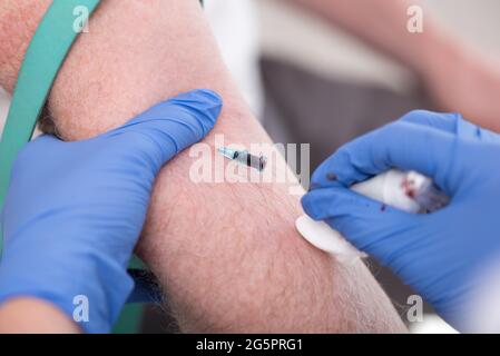 Catetere posizionato nella vena di un paziente Foto Stock