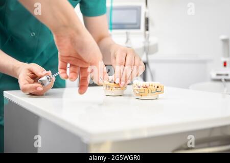 La mano del dentista tiene un mock-up artificiale della mascella e mostra i denti del paziente. Trattamento in clinica dentale. Primo piano. Foto Stock