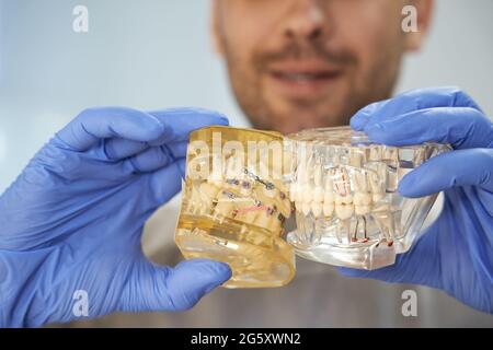 Dentista qualificato in guanti che tengono vicino due replicas denti Foto Stock