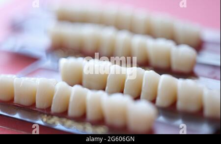 Set di dentarie è sul tavolo nel concetto di studio dentistico Foto Stock