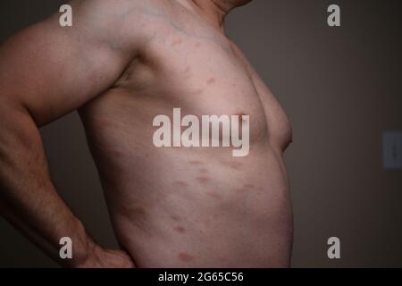 Diagnosi di malattie della pelle - allergie, psoriasi, eczema, dermatite. Foto Stock