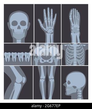 Illustrazione vettoriale Set di shot a raggi X. Mano, testa, ginocchio e altre parti del corpo umano su radiografie su sfondo bianco. Illustrazione Vettoriale