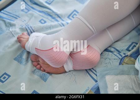 Gambe di una donna incinta in calze a compressione sul letto al momento del parto Foto Stock