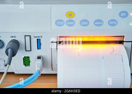 Dispositivo CTG con monitoraggio dello stato di salute della madre e del bambino durante il parto in ospedale. Dispositivo cardiotocografo per la misurazione di Foto Stock
