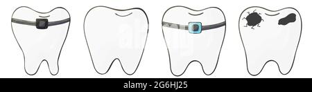 Volantino rettangolare, banner. Set di denti con disegno a mano. Raccolta di denti con bretelle, carie, crepe e denti sani Illustrazione Vettoriale