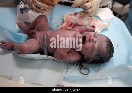 Maracaibo- Venezuela-19-06-2015- Maternity Castillo Plaza in Venezuela. un parto di un ragazzo da neonato controllato dal ginecologo. © JOSE ISAAC BULA Foto Stock