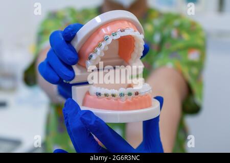 Medico che mostra denti dentali con bretelle dentali e staffe trasparenti Foto Stock