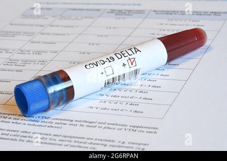 Provetta per sangue per il rilevamento del virus variante Covid-19 Delta con esito positivo su documento di carta. Foto Stock