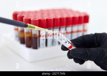 mani di un tecnico di laboratorio con provetta di campione di sangue e rack con altri campioni Foto Stock