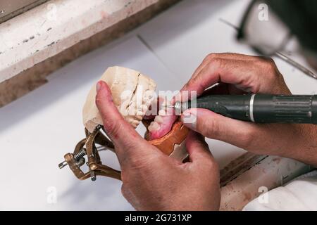 Mani di un tecnico dentista che esegue il deposito di un impianto dentale Foto Stock