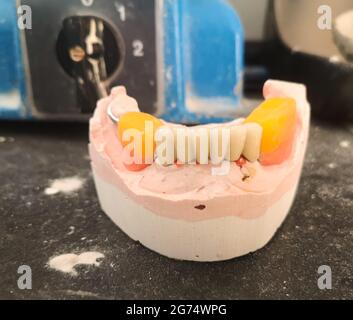 Un closeup di protesi e attrezzature di laboratorio dentale Foto Stock