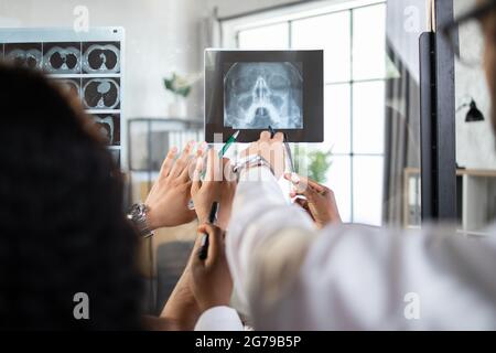 Vista posteriore delle mani dell'équipe medica multietnica, puntando alla scansione a raggi X della testa del paziente, discutendo diagnosi e trattamento. Lastra di vetro con scansioni a raggi X e MRI Foto Stock