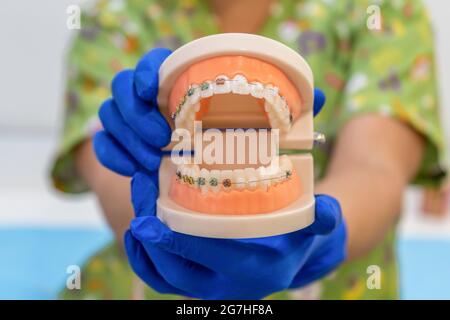 Medico che tiene dentini dentali professionali con dentini e staffe trasparenti Foto Stock