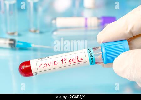 Medico con un campione di sangue positivo per la nuova variante rilevata del ceppo di coronavirus chiamato COVID DELTA. Ricerca di nuovi ceppi e mutazioni o Foto Stock