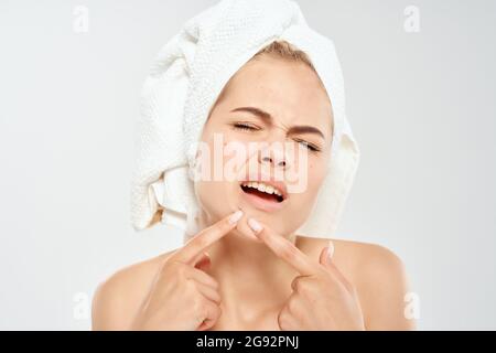 donna con un asciugamano sulla sua testa tiene una lente di ingrandimento vicino faccia acne Foto Stock