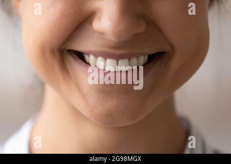 Primo piano di una donna indiana sana e nooty beaming sorriso Foto Stock