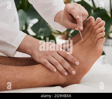 Trattamento dell'agopuntura per il dolore cronico del piede. Chiropractor che fa la terapia di agopuntura per i piedi del paziente con gli aghi. Riflessologia Foto Stock