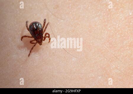 Primo piano di zecca marrone cane strisciando sulla pelle umana. Parassiti, encefalite, malattia di lyme, anaplasmosi, babesia, vaccinazioni e concetti di salute. Foto Stock