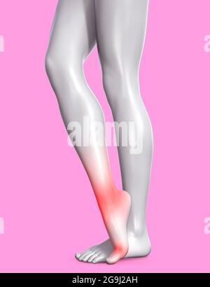 rappresentazione in 3d della figura femminile con area tarsale o ancale infiammata rossa su sfondo blu, concetto di clinica traumatologica. Foto Stock