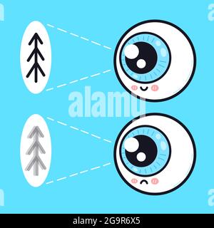 Carino triste e felice organo oculare umano guardare sul personaggio albero. Disegno di icone di illustrazione di cartoni animati di doodle del vettore. Cura degli occhi, cattivo, buona visione, concetto di carattere problema oculare Illustrazione Vettoriale