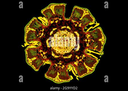 She-Oak (Casuarina), sezione trasversale attraverso lo stelo, MRI a contrasto di fase, ingrandimento x100 relativo ad una stampa di 10 cm di larghezza Foto Stock