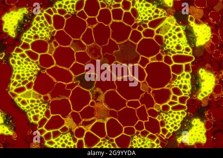 She-Oak (Casuarina), sezione trasversale attraverso lo stelo, MRI a contrasto di fase, ingrandimento x100 relativo ad una stampa di 10 cm di larghezza Foto Stock